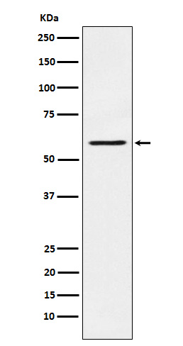 WB - PAK1 Antibody AP91577